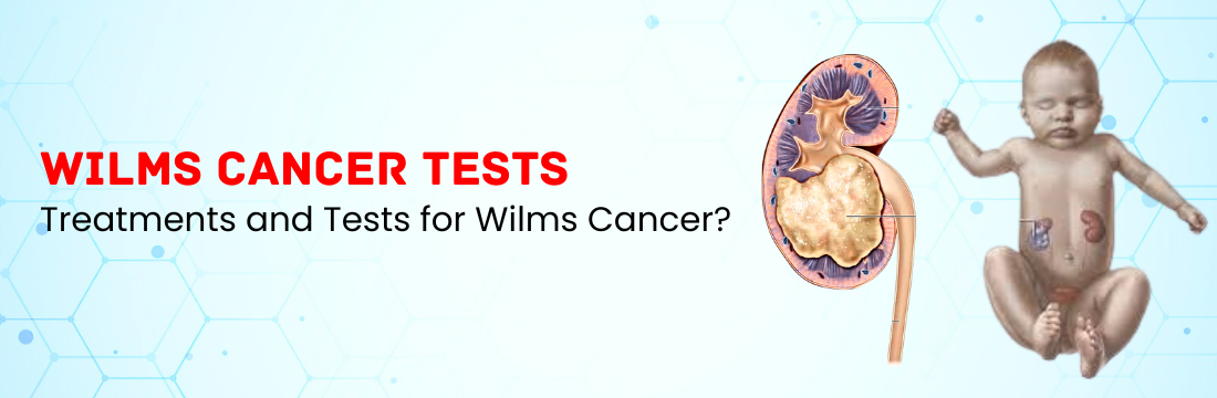 What Are the Treatments and Tests for Wilms Cancer?
